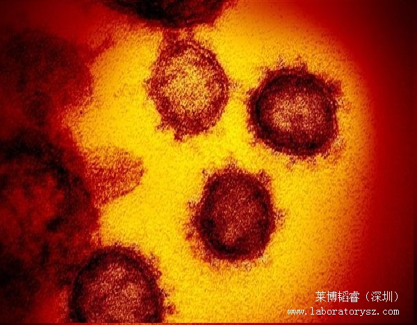 新冠病毒扫描电镜图片